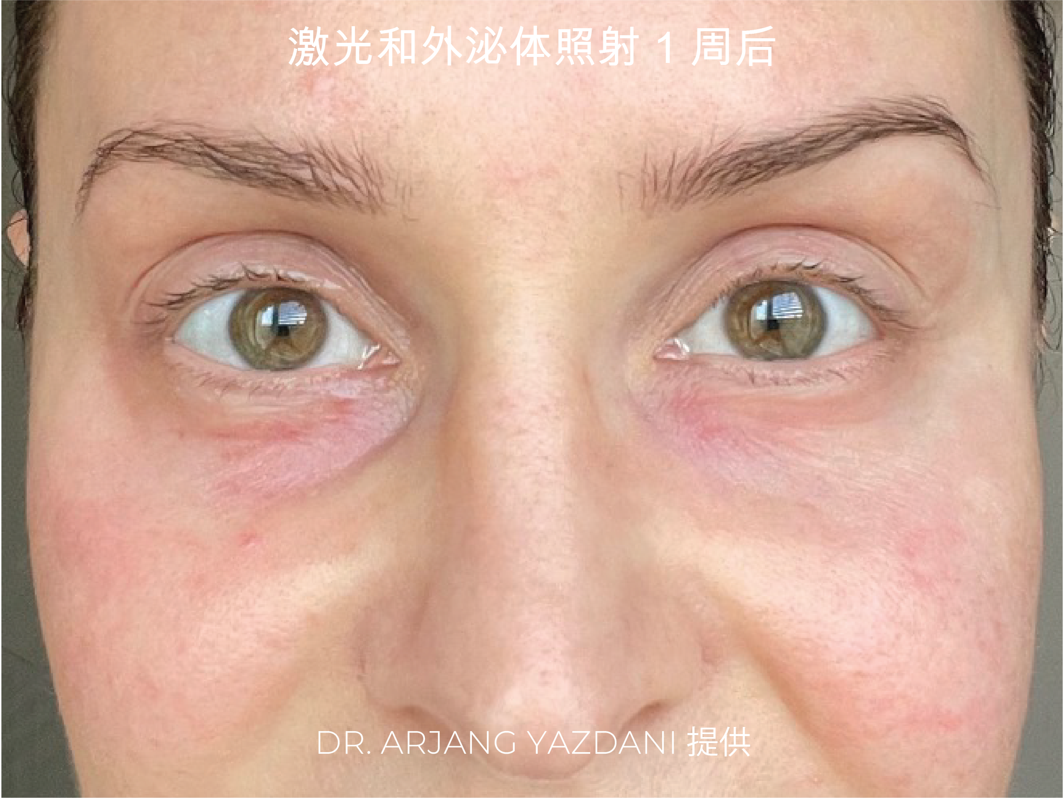 Caileys Journey CH-03