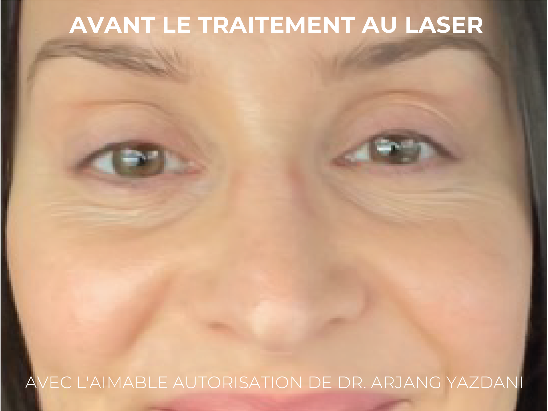 Caileys Journey FR-04