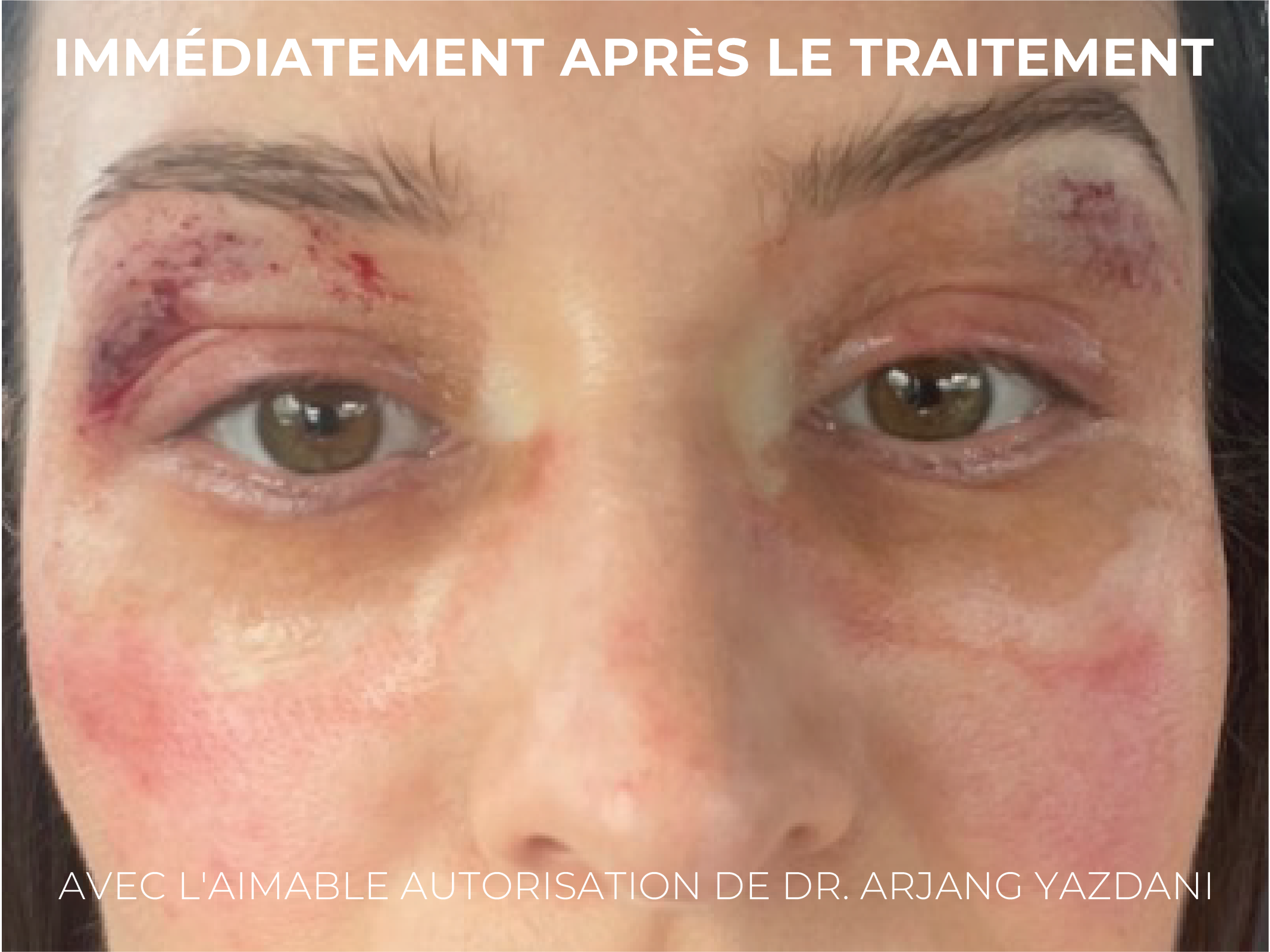 Caileys Journey FR-05-2