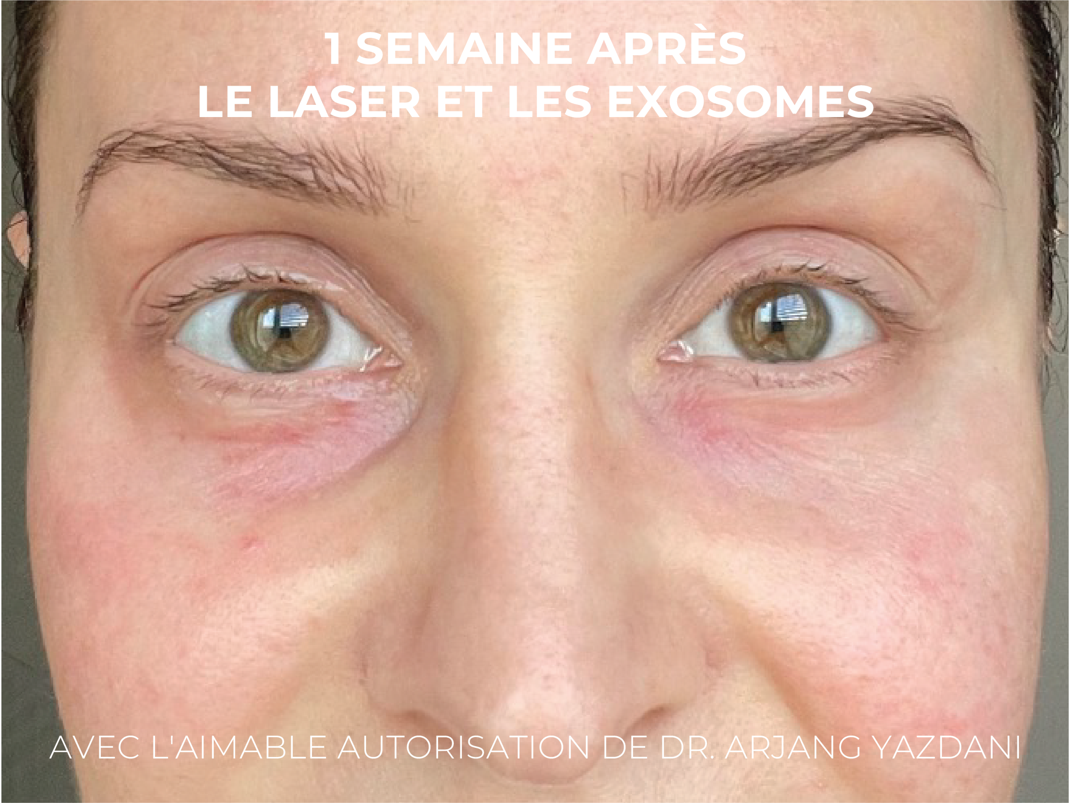 Caileys Journey FR-06